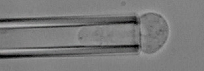 Micropipette aspiration of a cancer cell. Photo by Dr. David Tees.