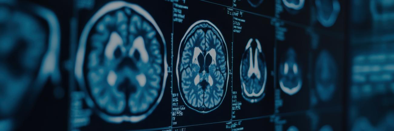 illustration of MRI brain scans