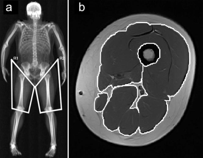 Image of a DXA and MRI scan of a skeletal system and a brain, respectively