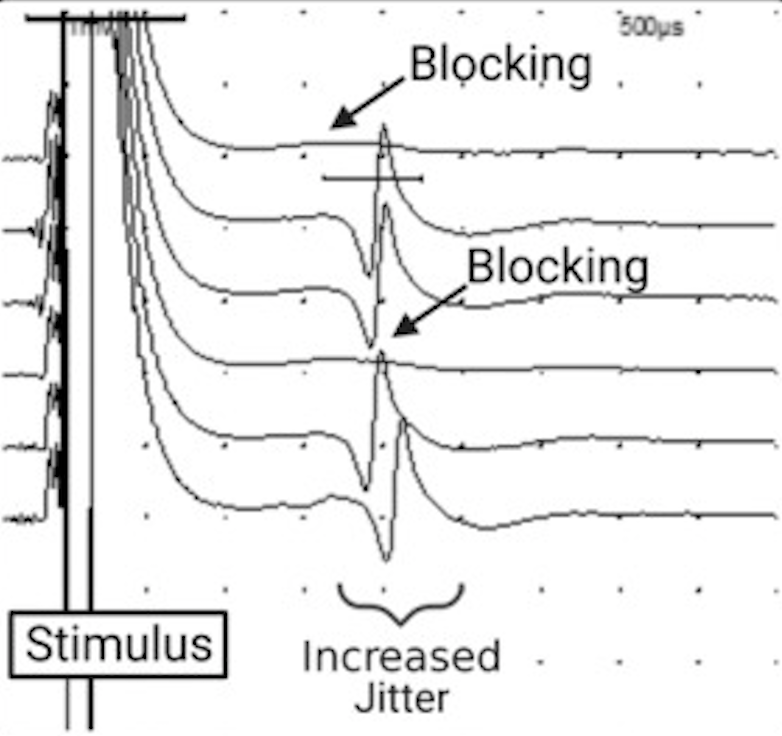 A graphic of scientific measurements of stimulus