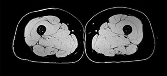 Interventional Strategies to Enhance Physical Function illustration
