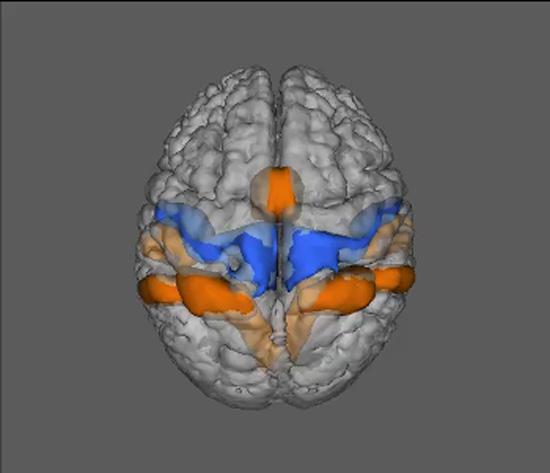 An illustration of a brain