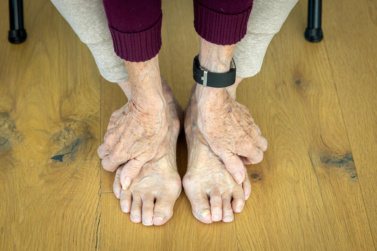 The hands and feet of an older person
